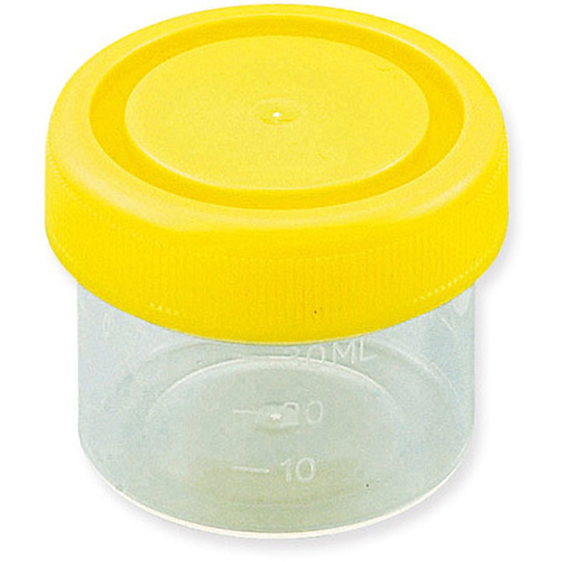 標本容器 1箱(100個) アズワン 【通販モノタロウ】