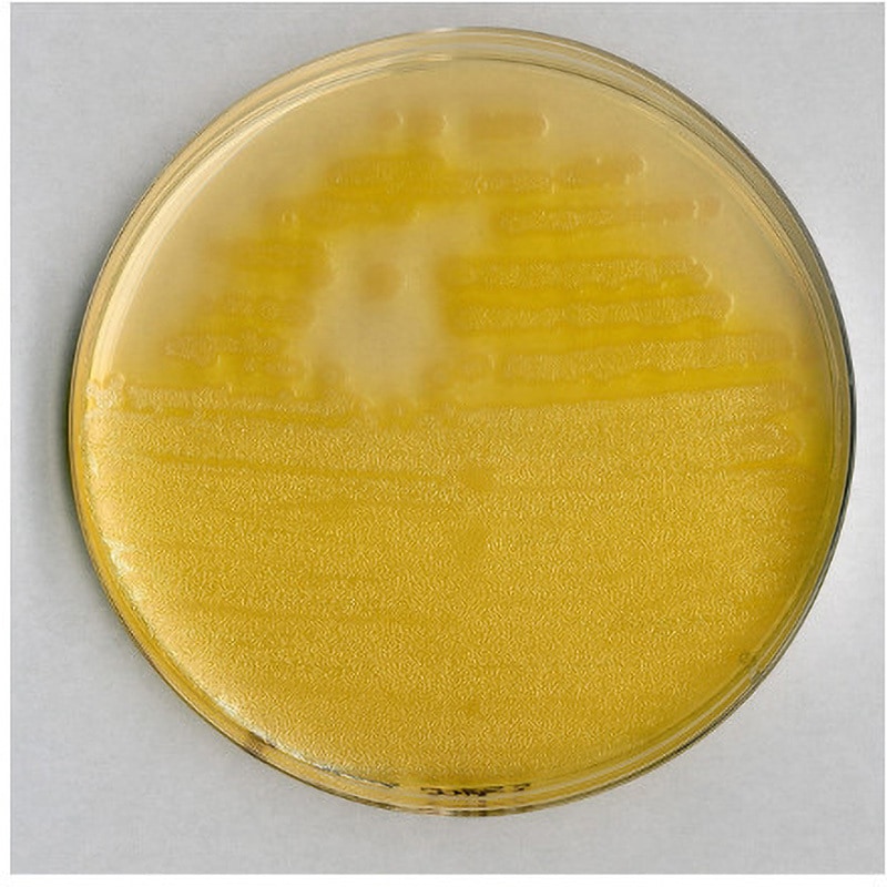 1.10989.0500 シュードモナス寒天 F 基礎培地 微生物学用 110989 500G 1個 Merck(メルクミリポア) 【通販モノタロウ】