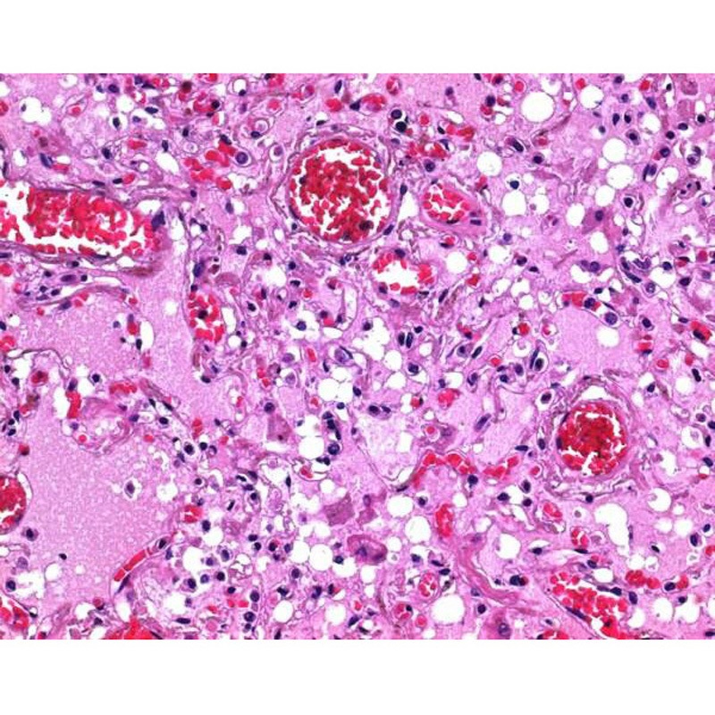 ペレットタイプ パラフィン 1組(2.5kg×4袋) Merck(メルクミリポア) 【通販モノタロウ】