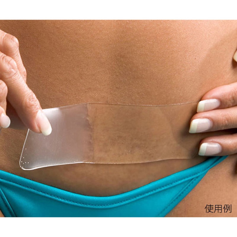 エピダーム 1個(1枚) ザイコア・インターナショナル・インク 【通販モノタロウ】