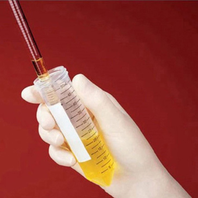 07-200-886 Fisherbrand(TM) Easy Reader(TM) 遠沈管/コニカルチューブ 1セット(10箱×50本) Thermo Fisher Scientific 【通販モノタロウ】