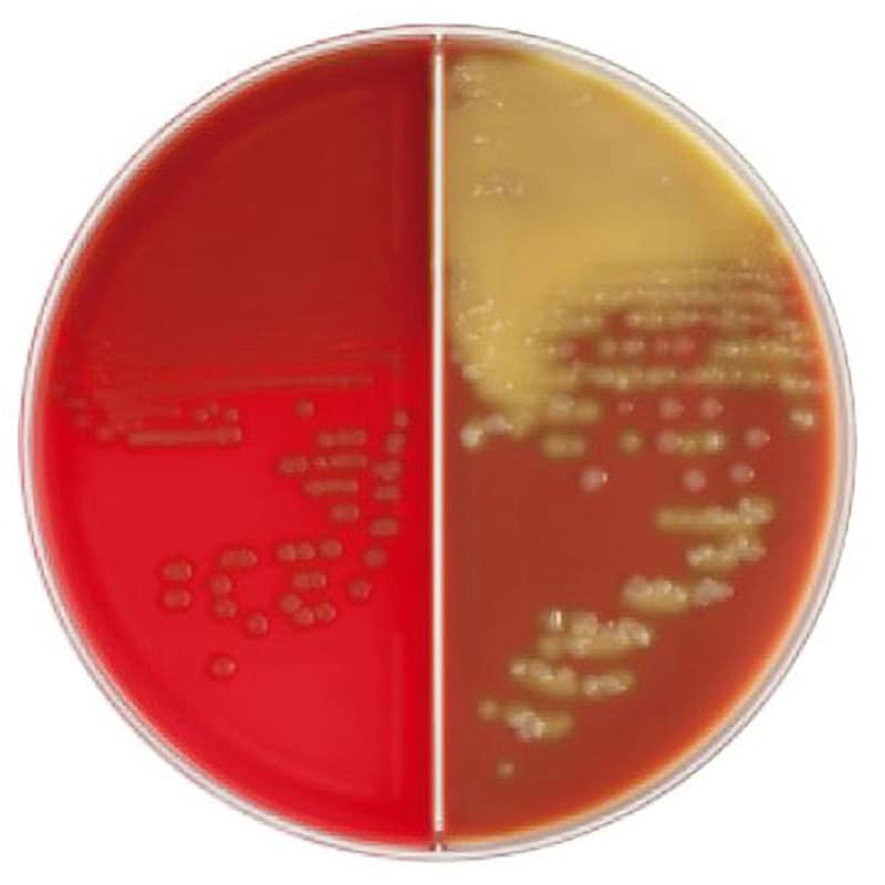 BD BBL TM TSAⅡ5%ヒツジ血液寒天培地/チョコレートⅡ寒天培地 冷蔵