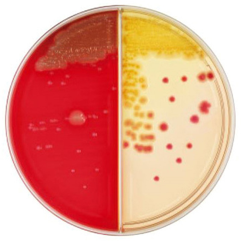 252022 BD BBL TM TSAⅡ5%ヒツジ血液寒天培地/DHL寒天培地 100枚
