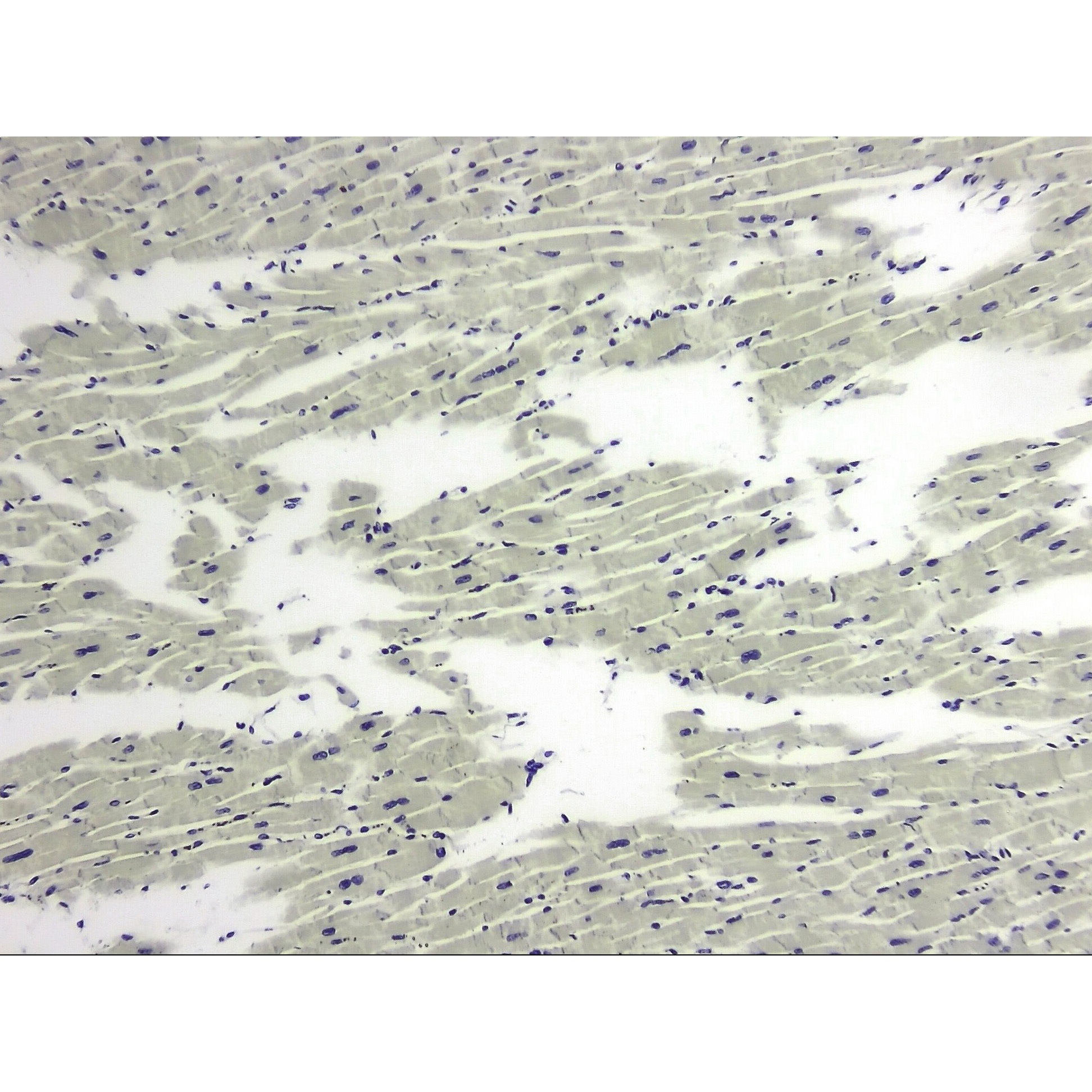 L55-8356 心筋プレパラート(10枚) 1組(10枚) ナリカ 【通販モノタロウ】