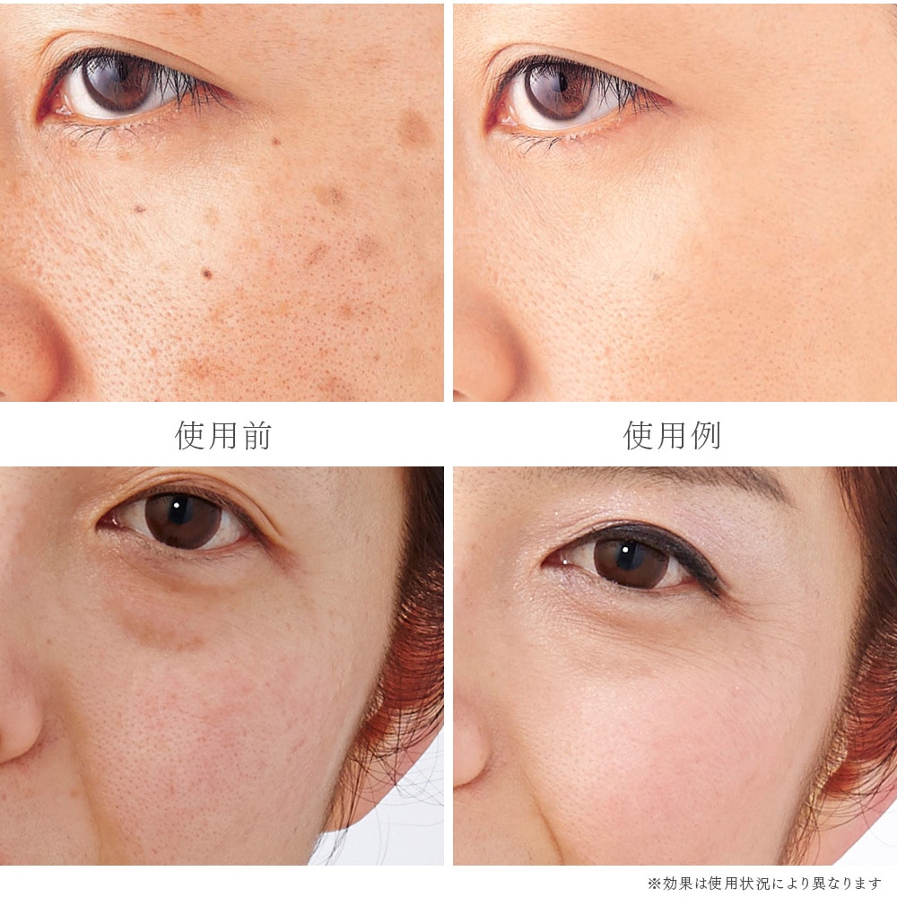 アンファティ カラーファンデーション ８点 ピンクオークル グリーン イエロー アンファティ / アンファティ カラー IFの商品情報｜美容