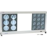 グローランプシャウカステン(卓上壁掛 半切判1枚掛 24-4974-0001 50Hz 森山X線用品 LH-1(ハンセツ1マイ・1ダン) 森山X線用品