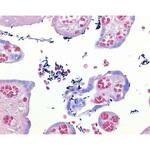ルゴール溶液 ヨウ素ヨウ化カリウム液 グラム染色用 109261 1L Merck(メルクミリポア)