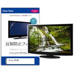 mat-moni-k0001581241 液晶保護フィルム  Pixio PX160 15.6インチ 反射防止 モニター メディアフューチャー