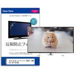 mat-tv-k0001586401 TV用 液晶保護フィルム  ダイアモンドヘッド OVER TIME OT-3PT101AK 10.1インチ 反射防止 テレビ メディアフューチャー