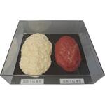 SKT-010 脂肪/筋肉対比セット(1Kg) イワイサンプル