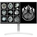 クリニカルレビュー用モニター 27インチ8MP Clinical Review Monitor ホワイト LG