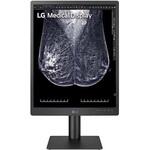 診断用モニター 21.3インチ5MP VAマンモグラフィ画像 Diagnostic Monitor LG