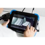 3D計測機能付き工業用内視鏡 GAZE02 スリーアールソリューション