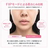APMRY53 ANLAN Rose Lumi 美顔器 ANLAN 05824976