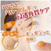- イポロン G 150g グリム 56735440