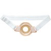 固定ベルト・2 (ストーマ用装具固定具) アルケア