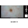 DE370 【レンタル】デジタルダーマトスコープ DE370 ナビス(アズワン) 64211719
