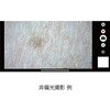 DE370 【レンタル】デジタルダーマトスコープ DE370 ナビス(アズワン) 64211719