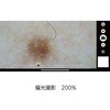 DE370 【レンタル】デジタルダーマトスコープ DE370 ナビス(アズワン) 64211719