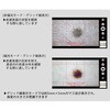 DE370 【レンタル】デジタルダーマトスコープ DE370 ナビス(アズワン) 64211719