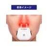 DN-1 ドクターノーズ LED Red Light 鼻のスマートセルフケア グロックス 83043515