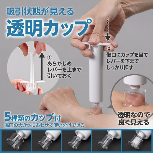 吸引状態が見える透明カップ。手順（1、あらかじめレバーを上まで引いておく。2、傷口にカップを当てレバーを下までしっかり押す。）透明なので良く見える。5種類のカップ付。傷口の大きさにあわせて使い分けできる。